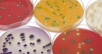 Основные принципы и методы культивирования бактерий